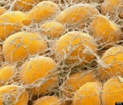 o-FAT-CELLS-570