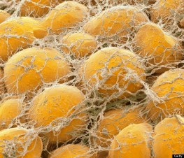 o-FAT-CELLS-570