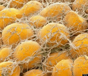 o-FAT-CELLS-570
